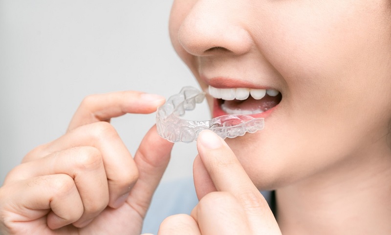 Invisalign Treatment Cost in Bangkok