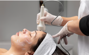 Laser Acne Treatment