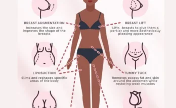 Mommy Makeover in Dubai